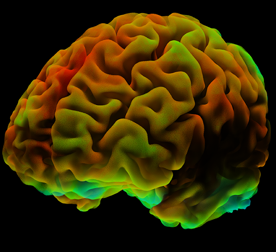 /SVG/new_svg_images/fMRI_Brain_Activity.png